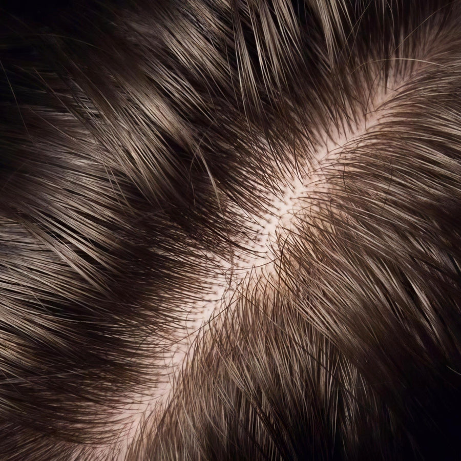 Purified Scalp